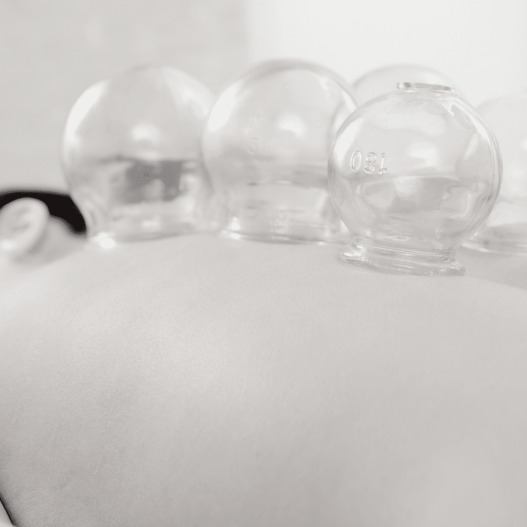 Cupping therapy near montreal